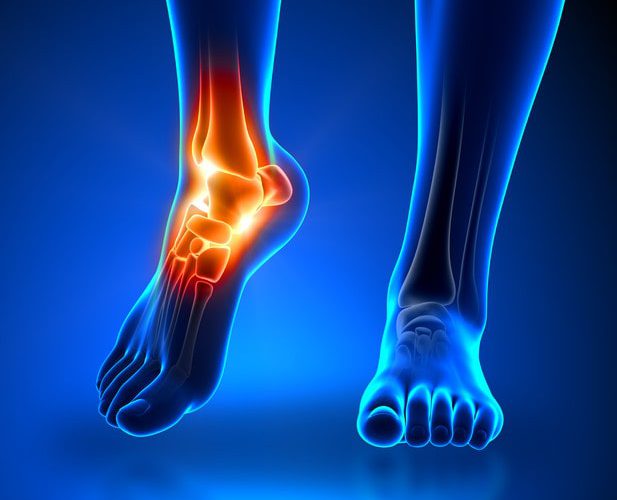 فیزیوتراپی قرارداد بانک رفاه